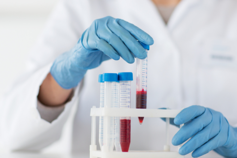 Blood General Testing