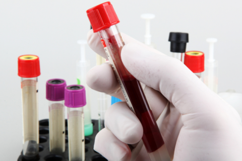 Blood General Testing