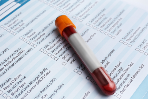 Laboratory Testing