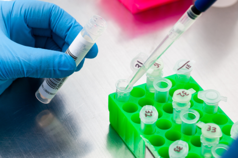 Prueba de laboratorio
